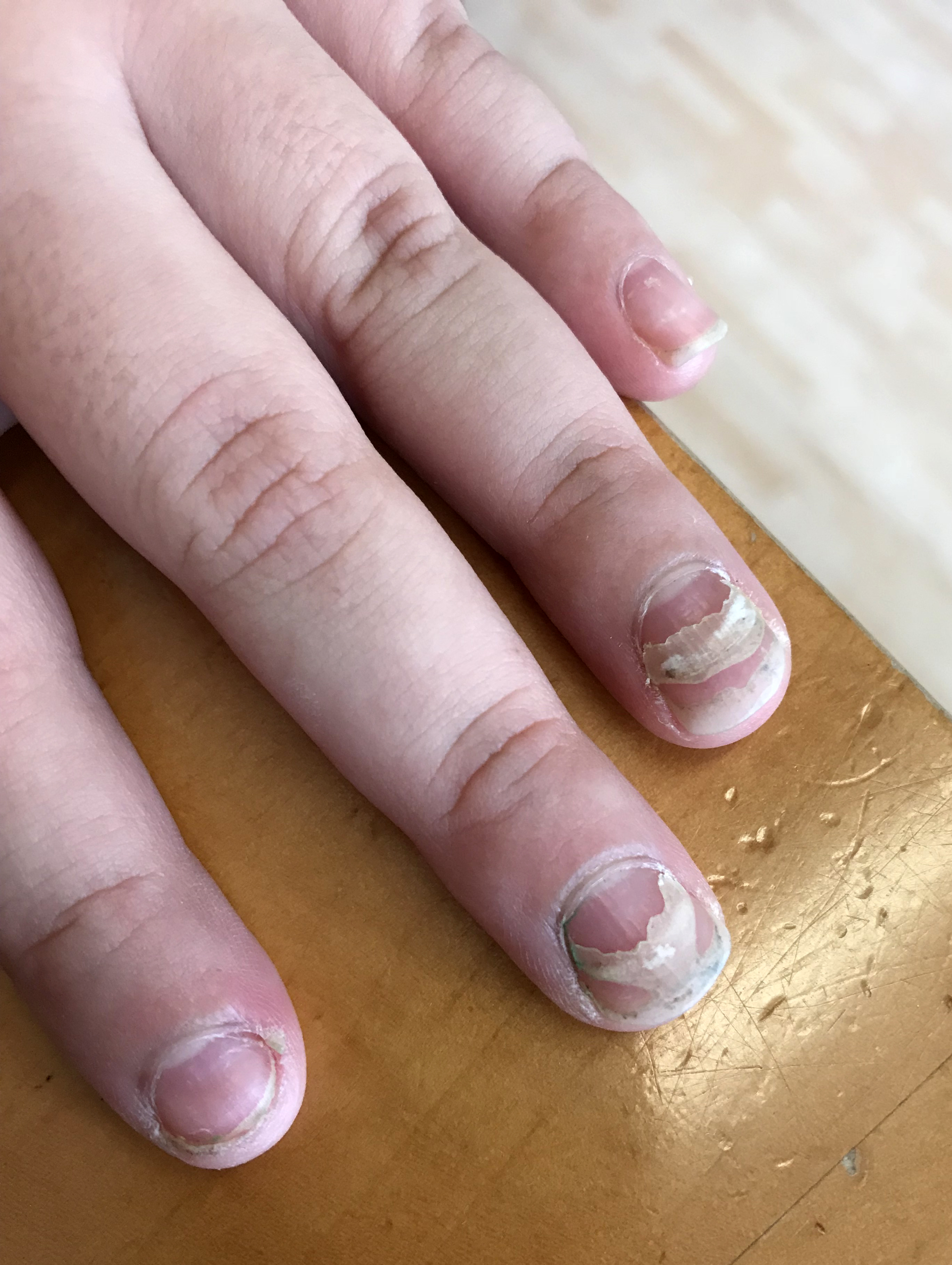 Dermatologist examination for nail changes and disorders